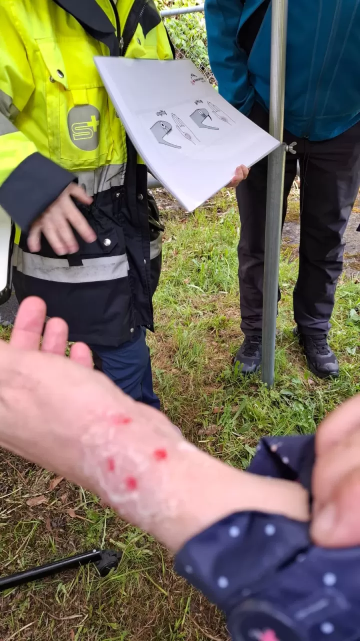 Moulage eines Schlangenbisses, mit Erklärung wie man Giftschlangen erkennt