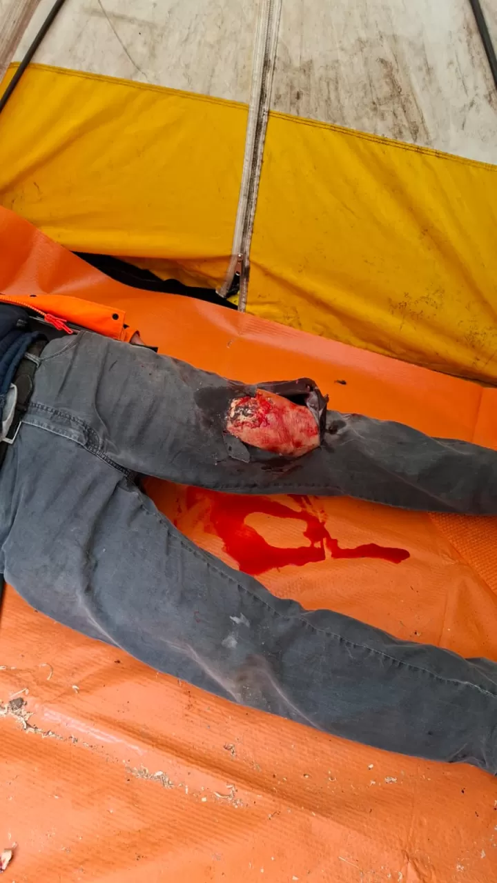 Moulage eines verletzten Knies